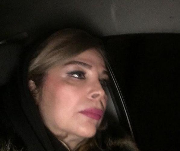 عکس قبل عمل شیوا خنیاگر