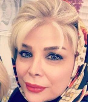 عکس قبل عمل شیوا خنیاگر