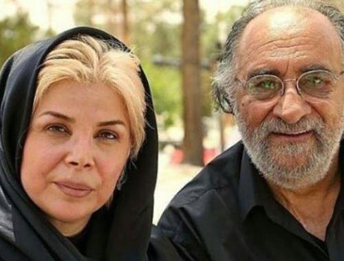 عکس قبل عمل شیوا خنیاگر