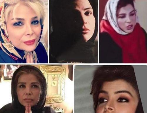 عکس قبل عمل شیوا خنیاگر