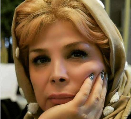عکس قبل عمل شیوا خنیاگر