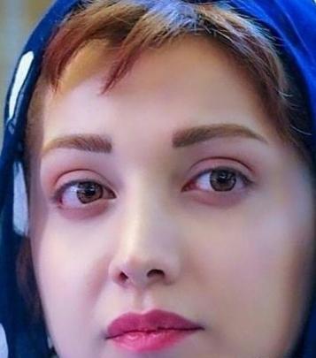 عکس روشنک گرامی قبل از عمل بینی