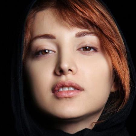 عکس روشنک گرامی قبل از عمل بینی