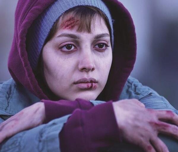 عکس روشنک گرامی قبل از عمل بینی