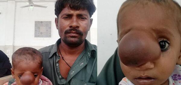 عکس وحشتناک بچه دزد