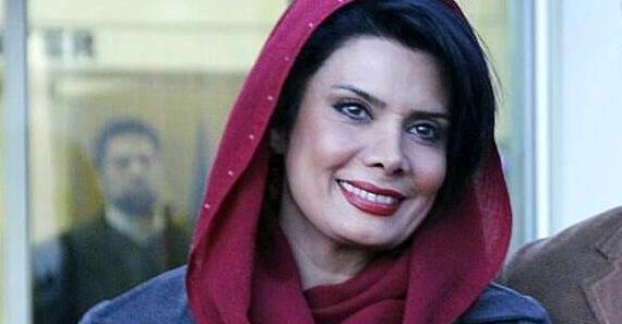 عکس عاطفه رضوی قبل از عمل زیبایی