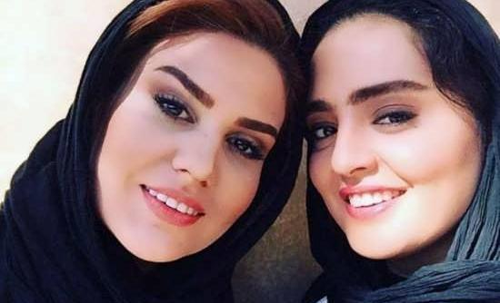 عکس عاطفه رضوی قبل از عمل زیبایی