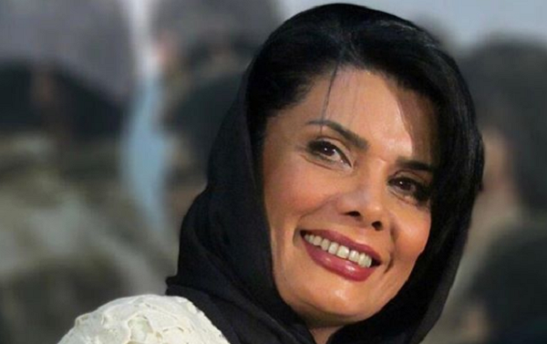 عکس عاطفه رضوی قبل از عمل زیبایی