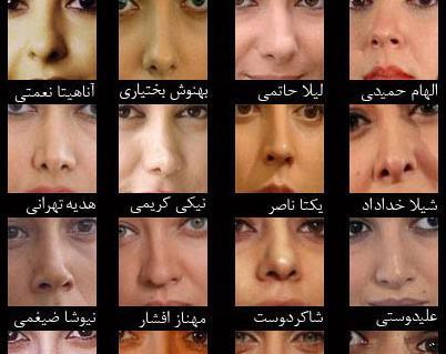 عکس عاطفه رضوی قبل از عمل زیبایی