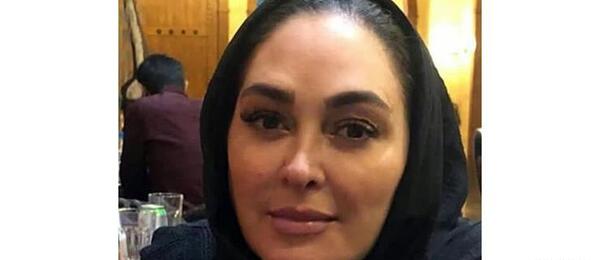 عکس امیرحسین آرمان بدون گریم