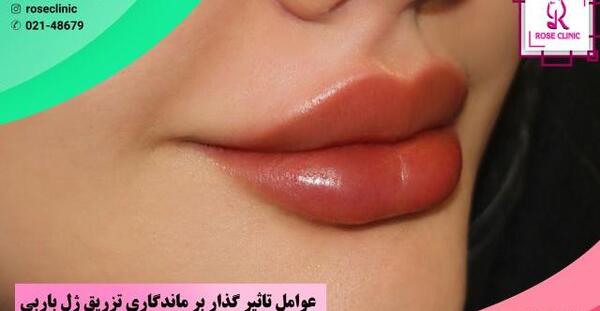 عکس لب عادی