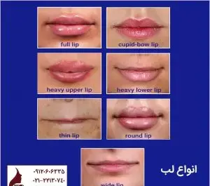 عکس لب عادی