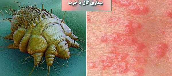 عکس پشه گال