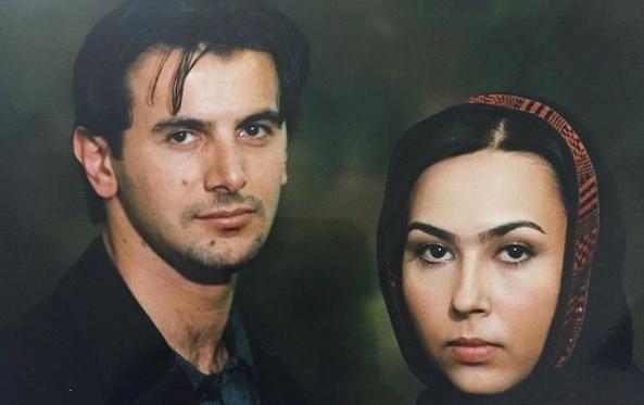 عکس پرستو صالحی قبل و بعد از عمل