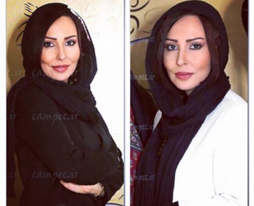 عکس پرستو صالحی قبل و بعد از عمل