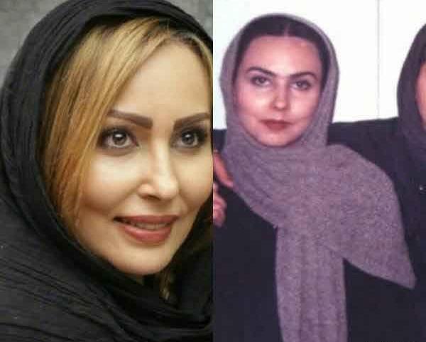 عکس پرستو صالحی قبل و بعد از عمل