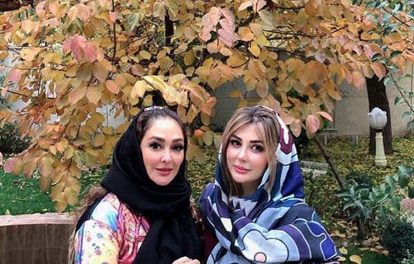 عکس الهام حمیدی قبل از عمل زیبایی