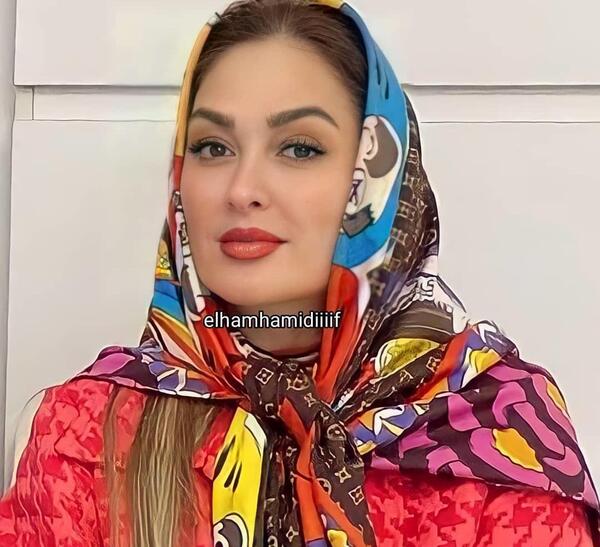 عکس الهام حمیدی قبل از عمل زیبایی