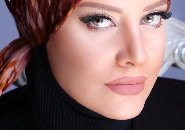 عکس شراره رخام بعد از تخلیه ژل لب