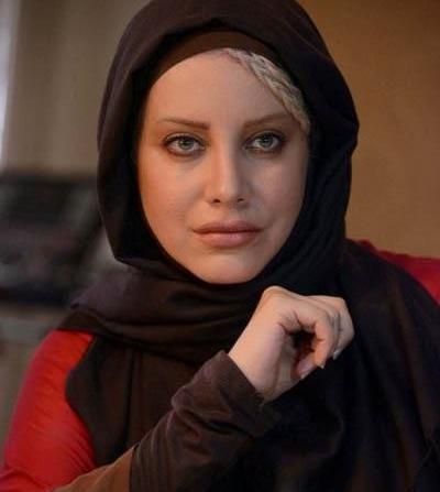 عکس شراره رخام بعد از تخلیه ژل لب