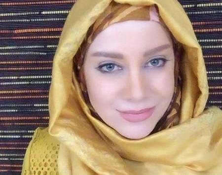 عکس شراره رخام بعد از تخلیه ژل لب