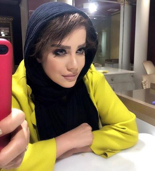 عکس شراره رخام بعد از تخلیه ژل لب