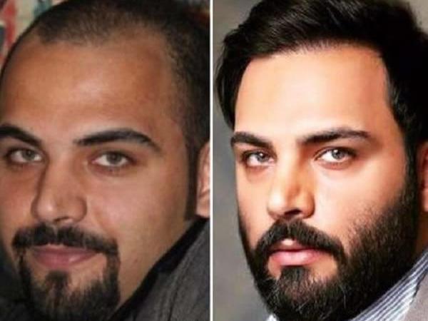 عکس رویا نونهالی ویکی پدیا