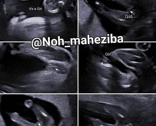 عکس سونو دختر نی نی سایت