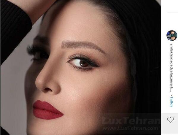 عکس شیلا خداداد قبل عمل بینی