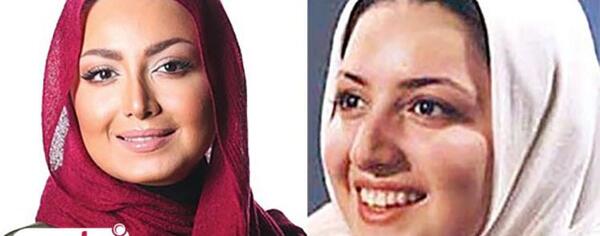 عکس شیلا خداداد قبل عمل بینی
