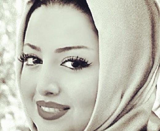 عکس شیلا خداداد قبل عمل بینی