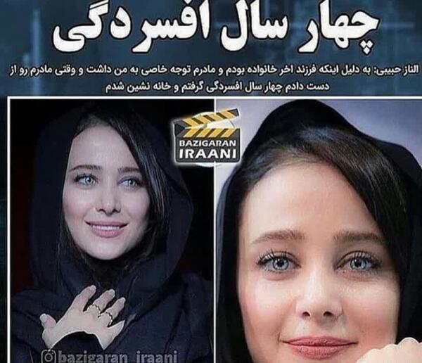 عکس الناز حبیبی قبل و بعد عمل