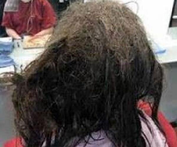 عکس شپش ترسناک