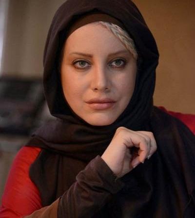 عکس شراره رخام قبل و بعد از تزریق ژل