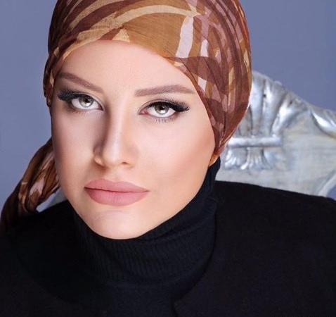 عکس شراره رخام قبل و بعد از تزریق ژل