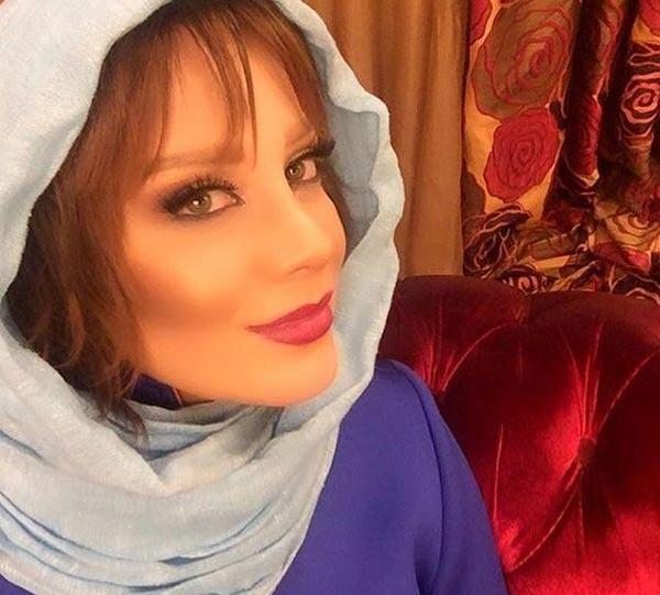 عکس شراره رخام قبل و بعد از تزریق ژل