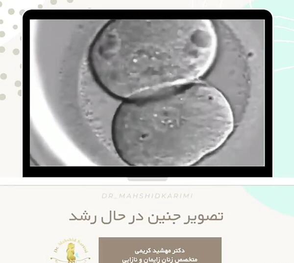 عکس جنین درحال رشد