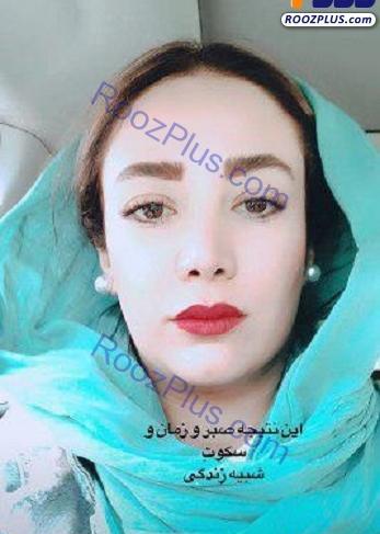 عکس صورت بهاره افشاری