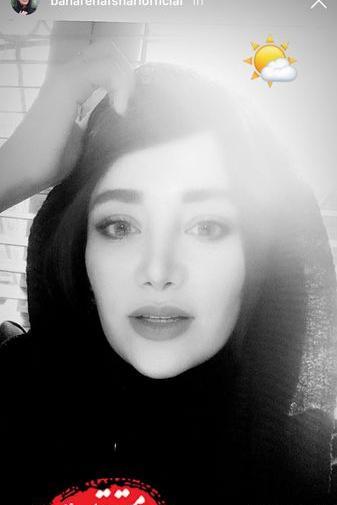 عکس صورت بهاره افشاری