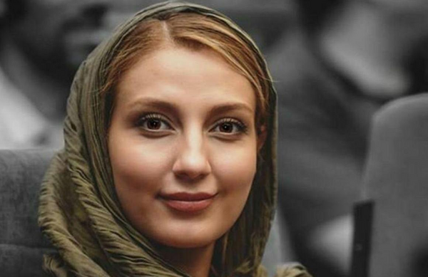 عکس حدیث میرامینی قبل از عمل