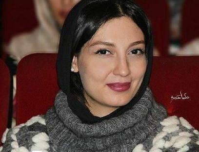 عکس حدیث میرامینی قبل از عمل
