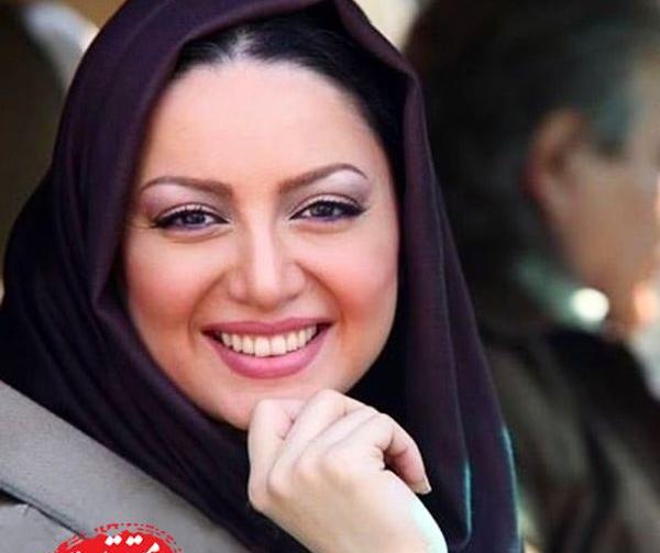 عکس حدیث میرامینی قبل از عمل