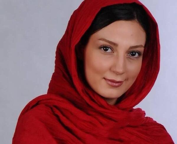 عکس حدیث میرامینی قبل از عمل