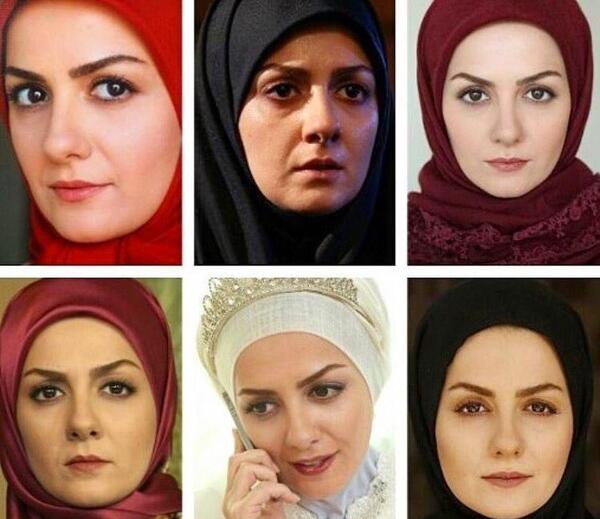 عکس قبل از عمل بیتا سحرخیز