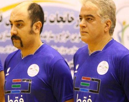 عکس برزو ارجمند بعد از کاشت مو