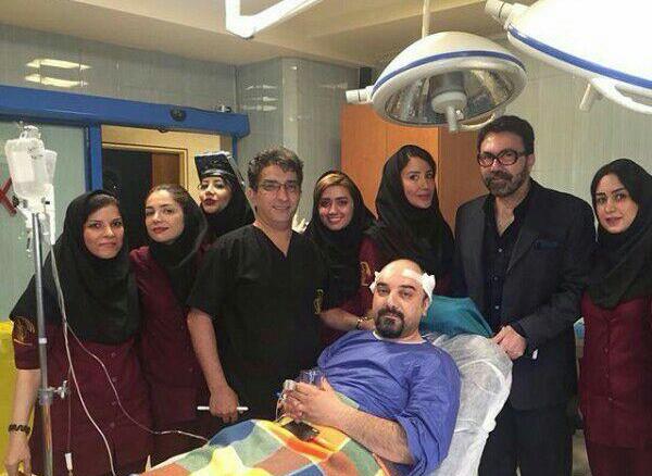عکس برزو ارجمند بعد از کاشت مو
