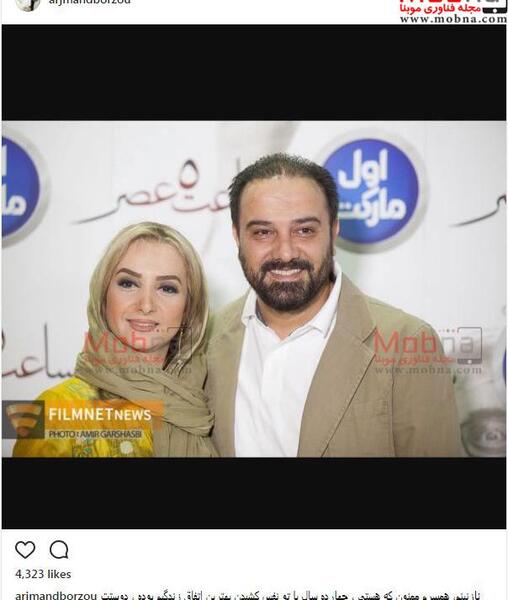 عکس برزو ارجمند بعد از کاشت مو