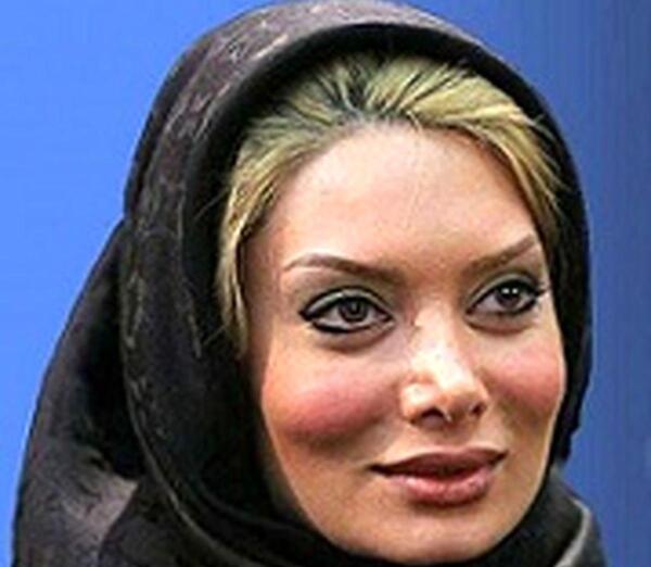 عکس شراره رخام قبل از عمل بینی