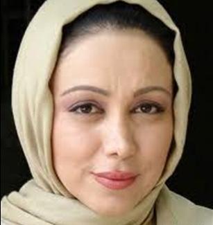 عکس بهنوش بختیاری قبل عمل بینی