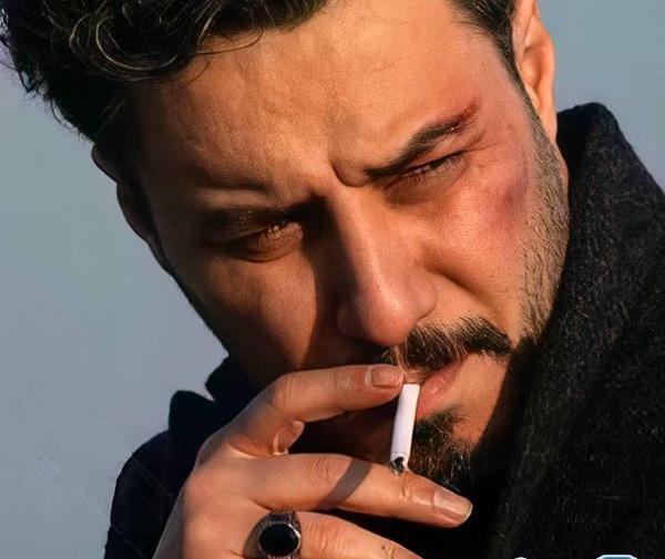 عکس جواد عزتی در سریال زخم کاری